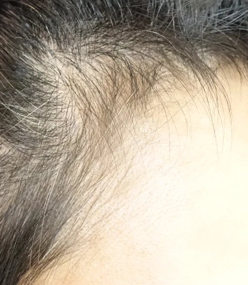 before_image