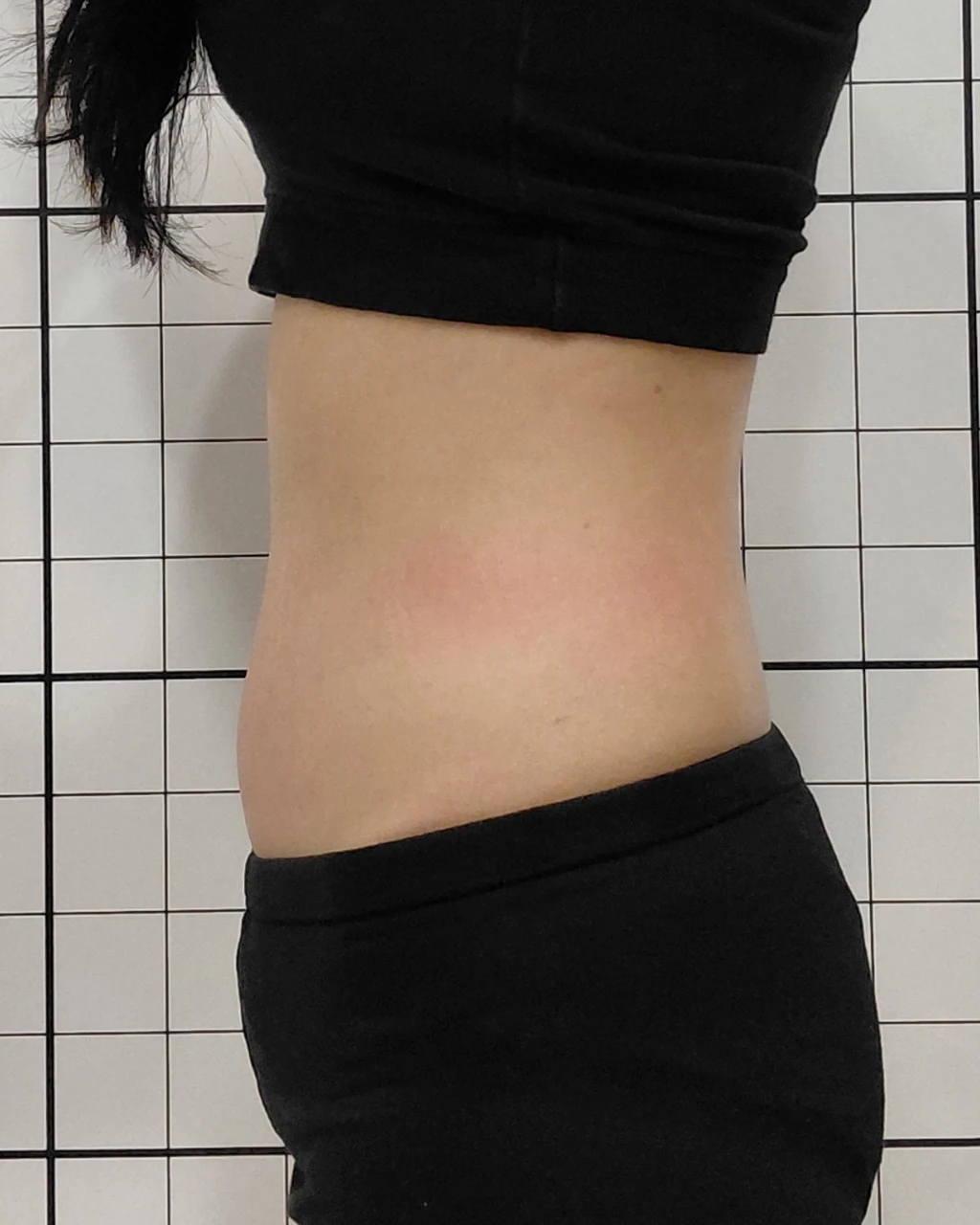 before_image