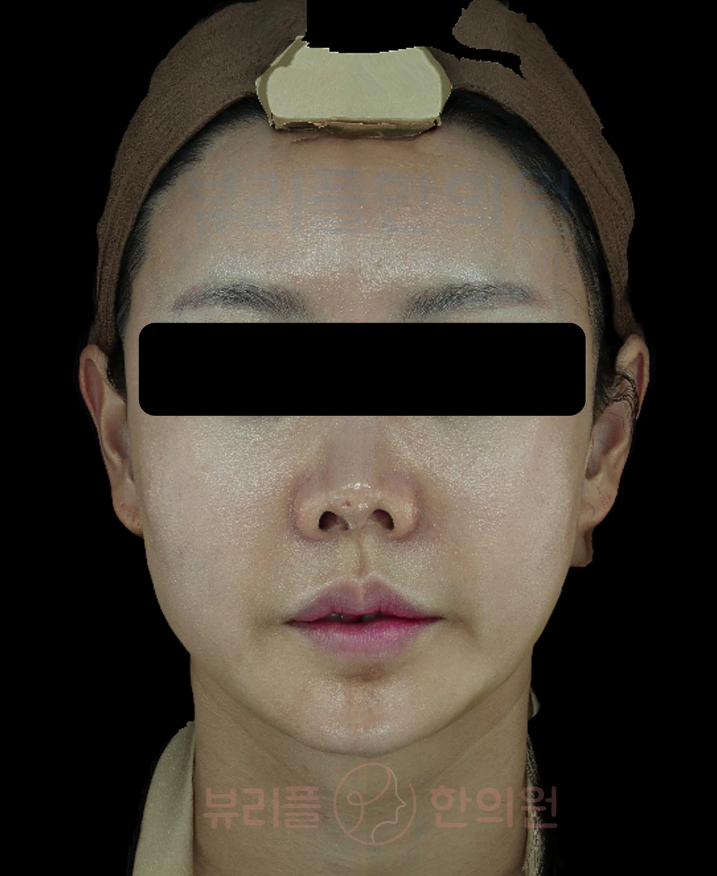 before_image