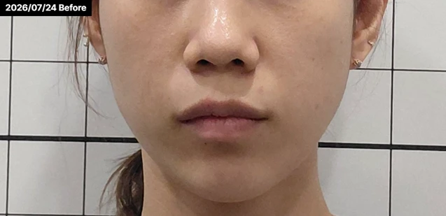 before_image