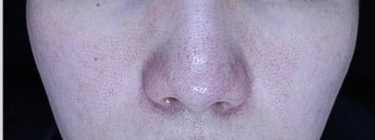 before_image