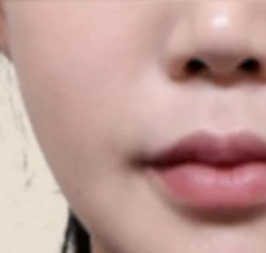 before_image