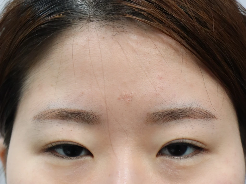 before_image
