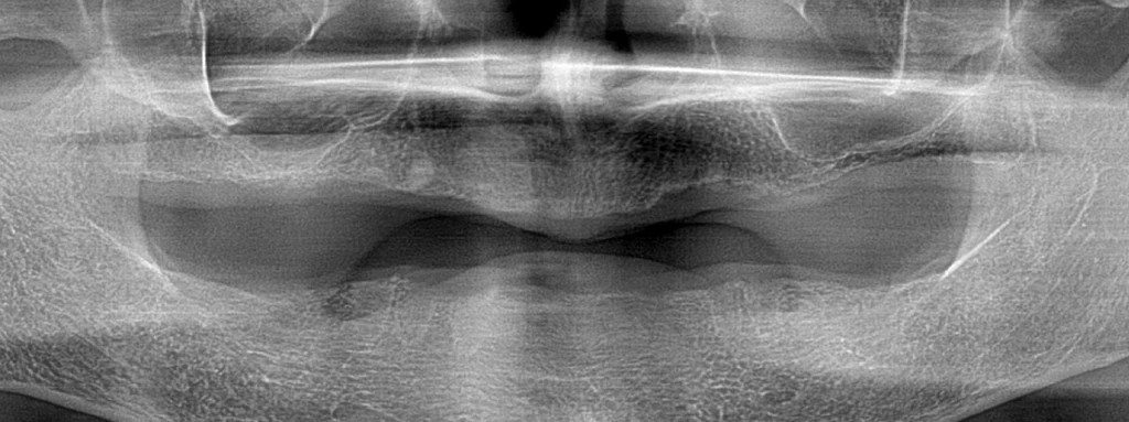 before_image
