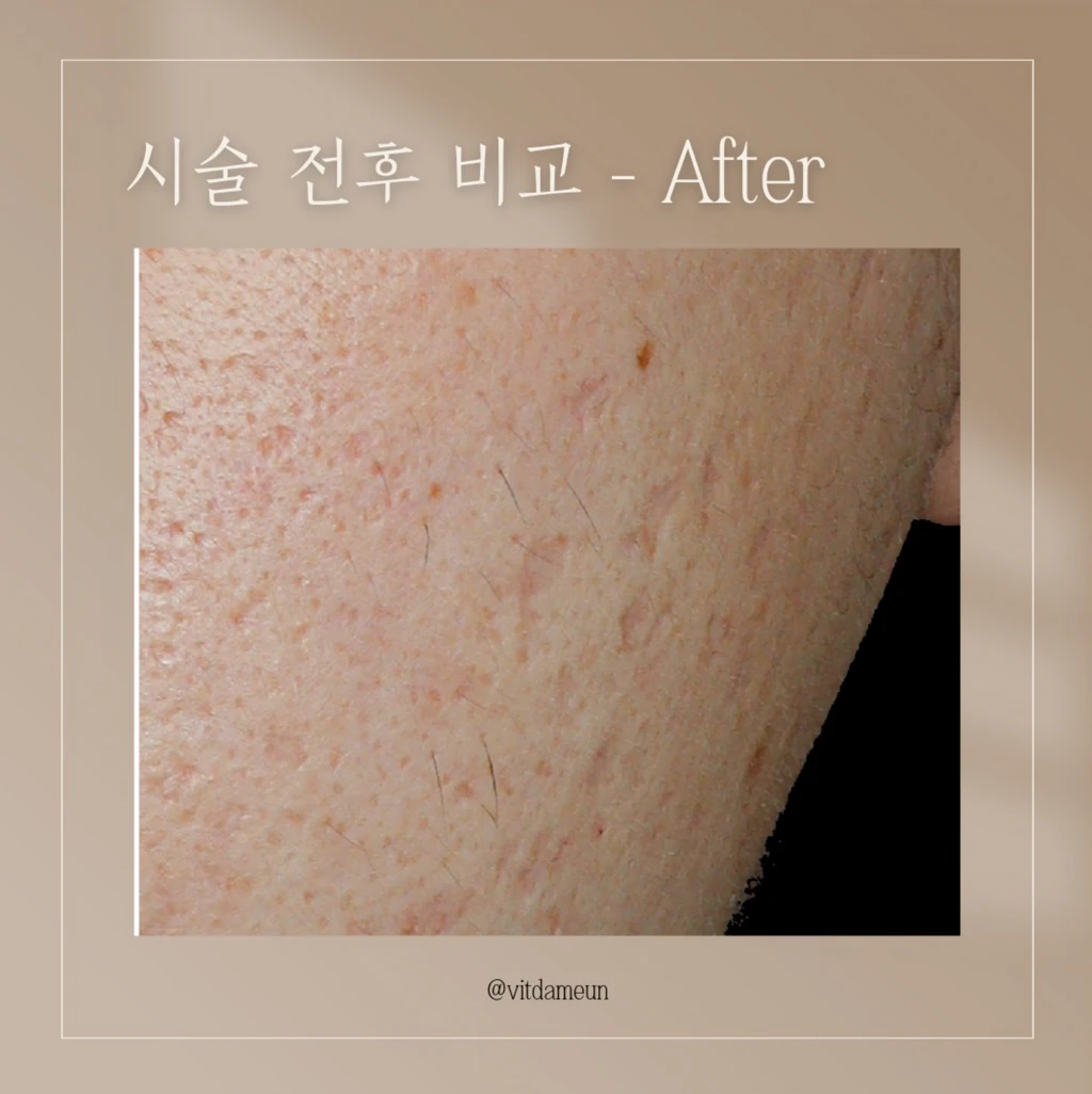 before_image