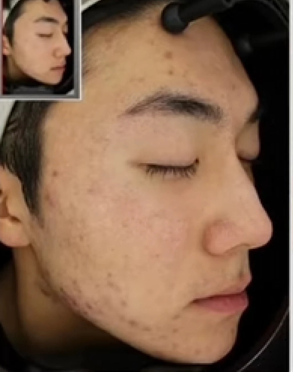 before_image