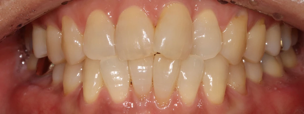 before_image