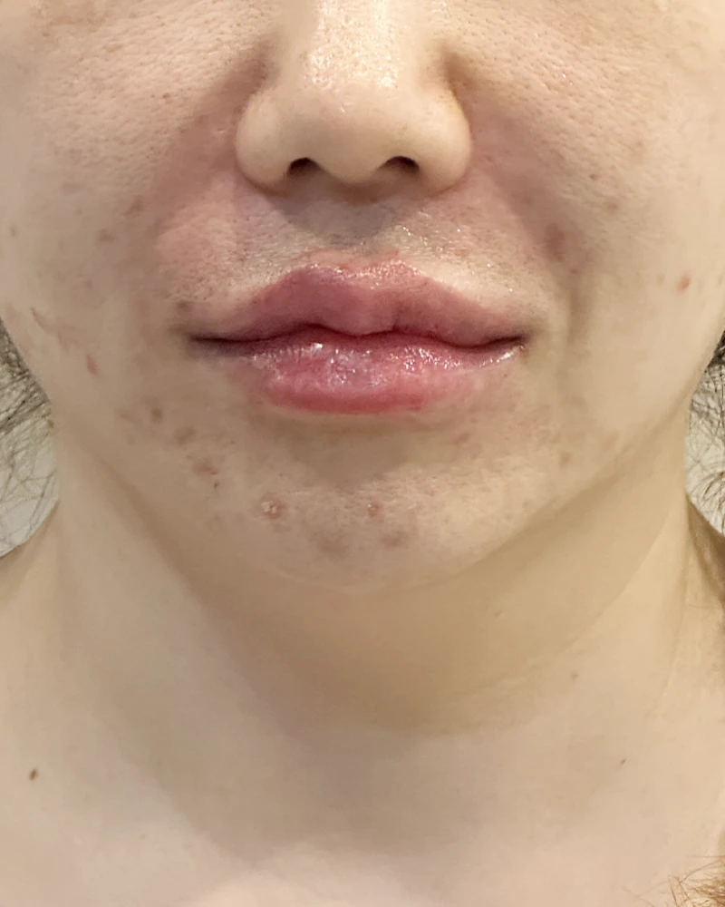 before_image
