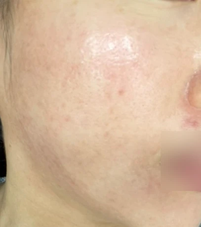 before_image