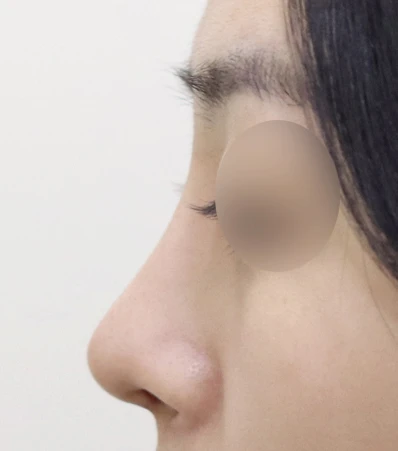 before_image