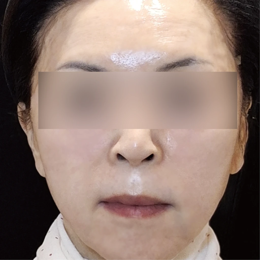 before_image