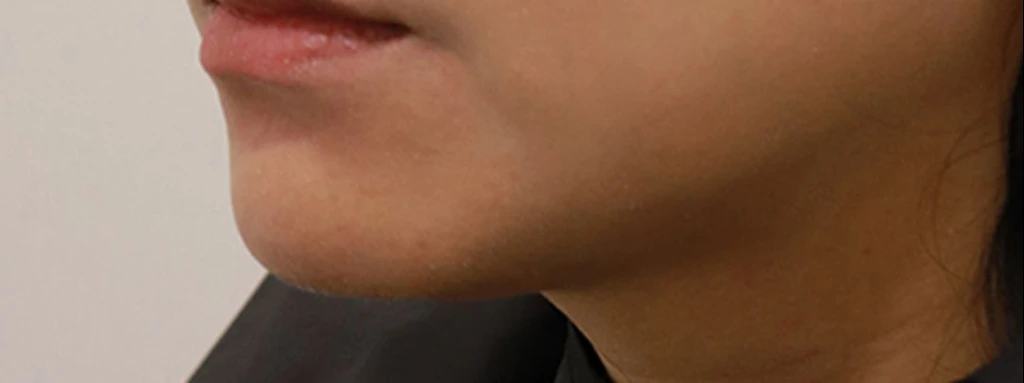 before_image