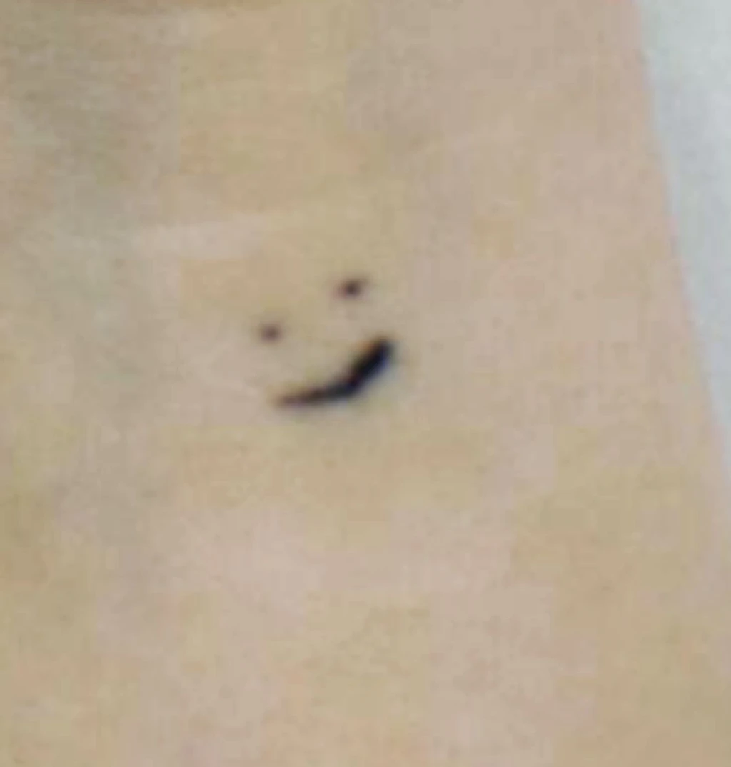 before_image