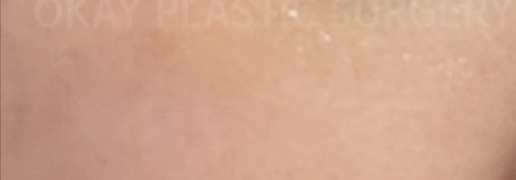 before_image