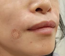 before_image