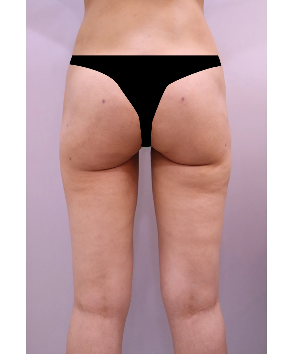 before_image