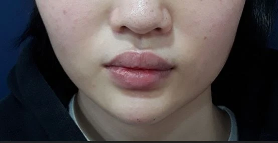 before_image