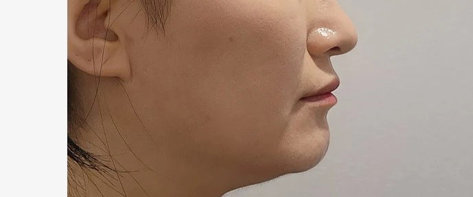 before_image
