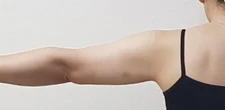before_image