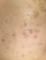 before_image