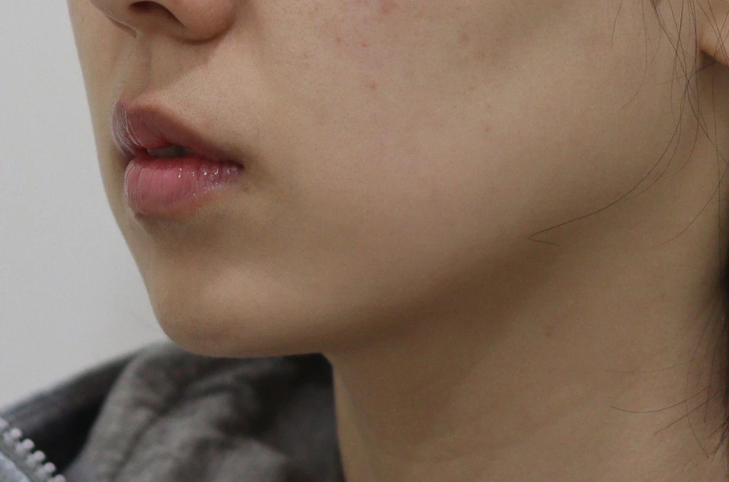 before_image