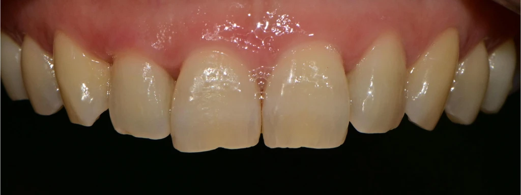 before_image