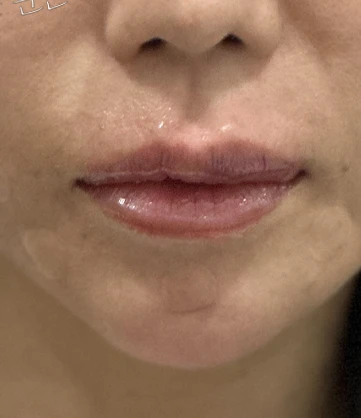 before_image