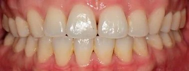 before_image