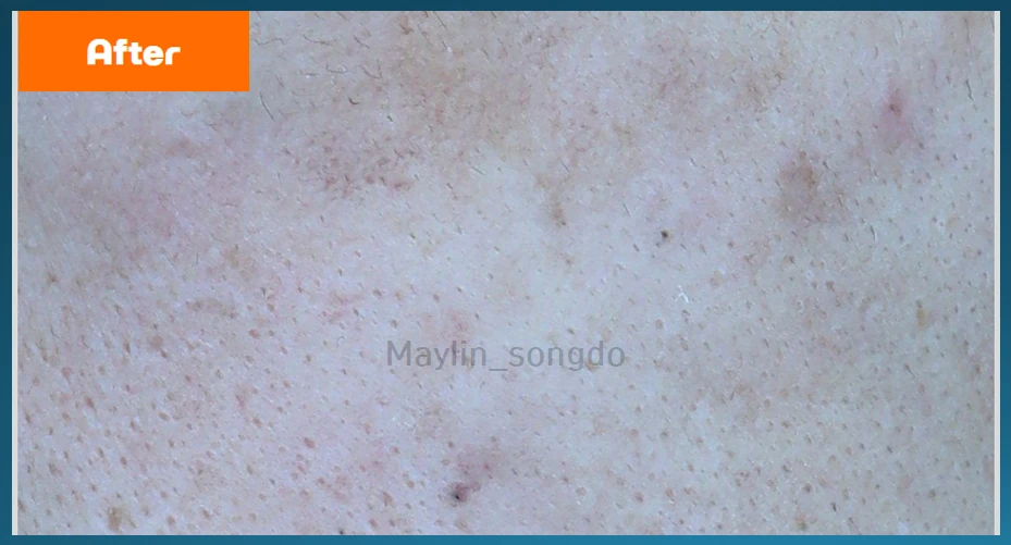 before_image