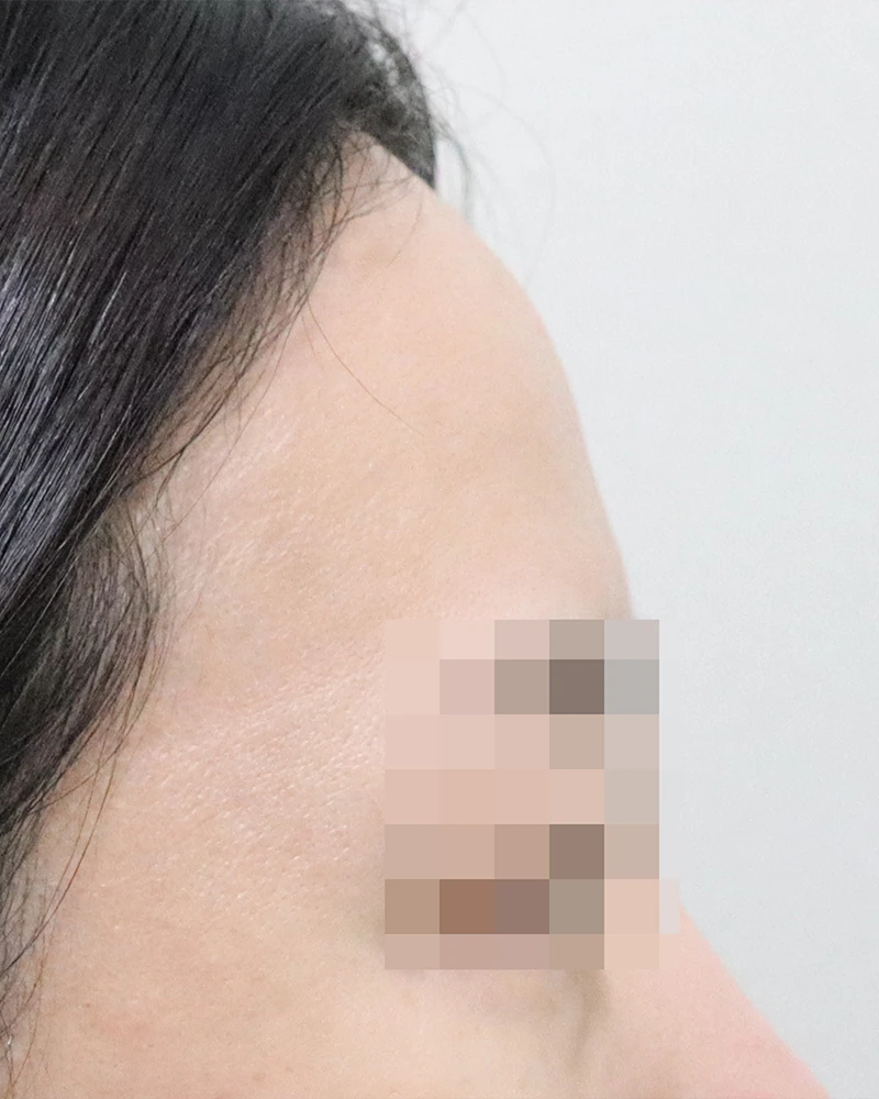before_image