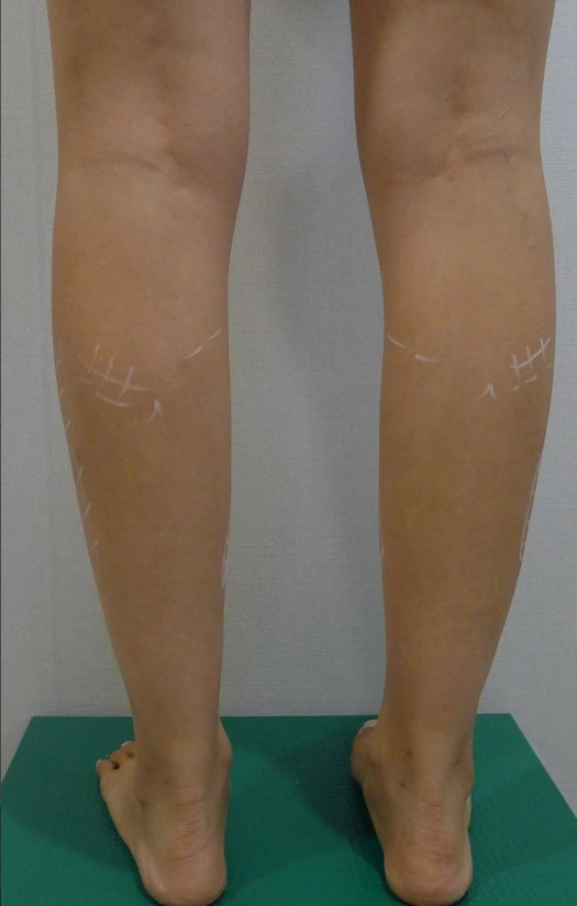 before_image