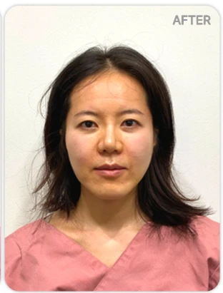before_image