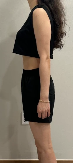 before_image