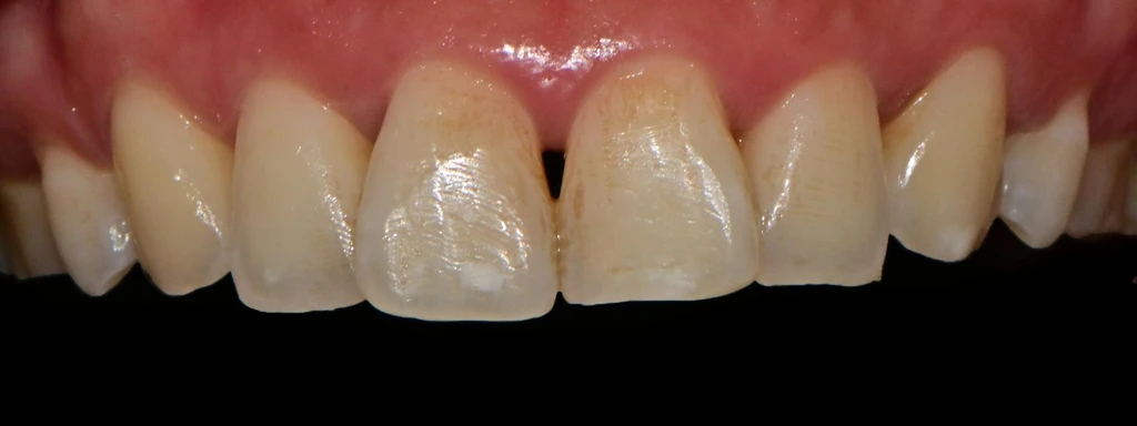 before_image