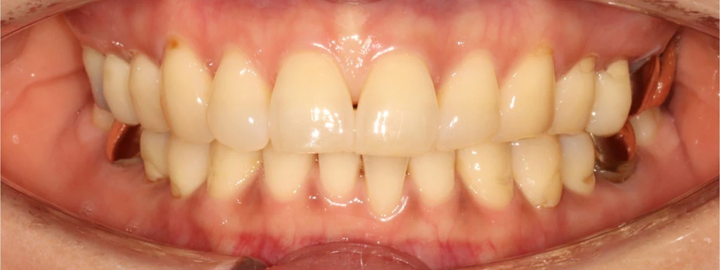 before_image