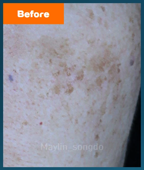 before_image
