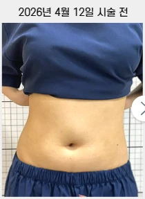 before_image