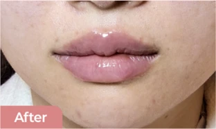before_image