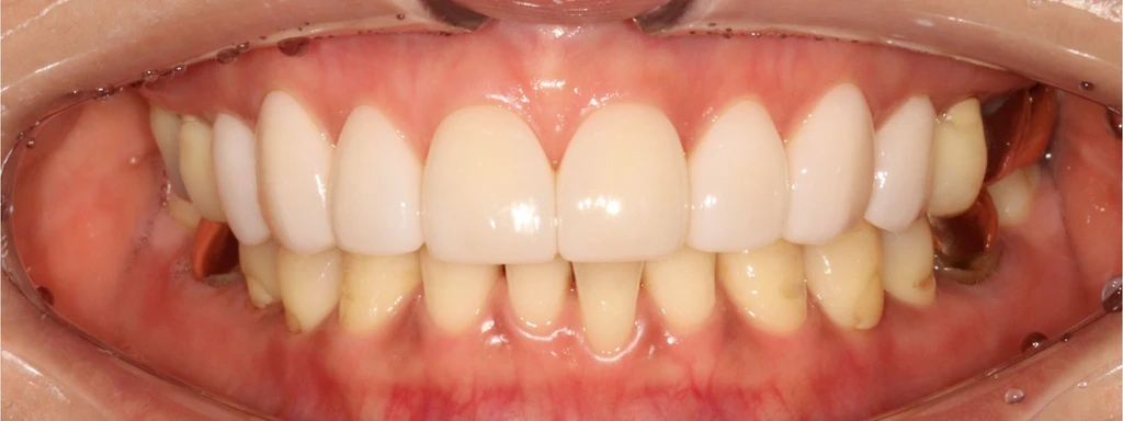 before_image