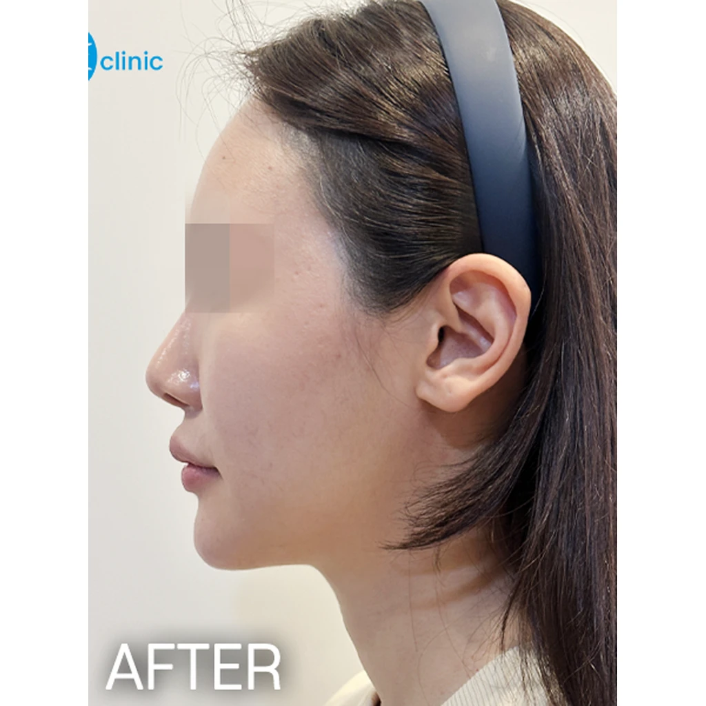 before_image