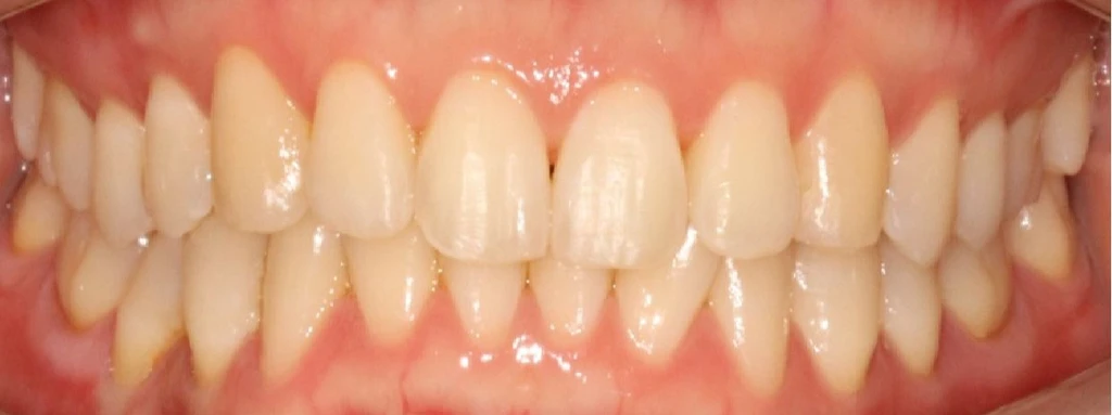 before_image