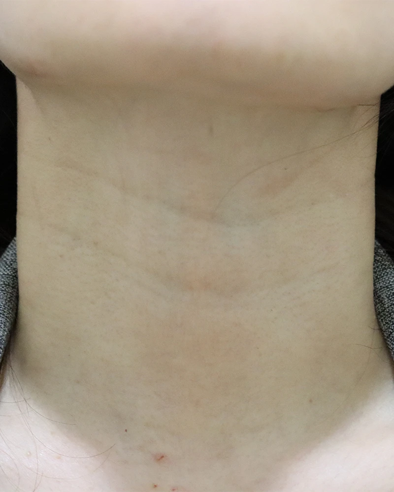before_image