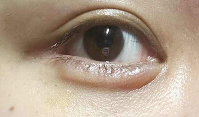 before_image