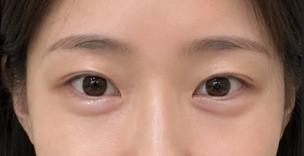 before_image