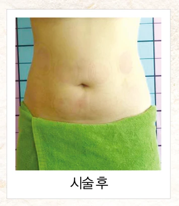 before_image