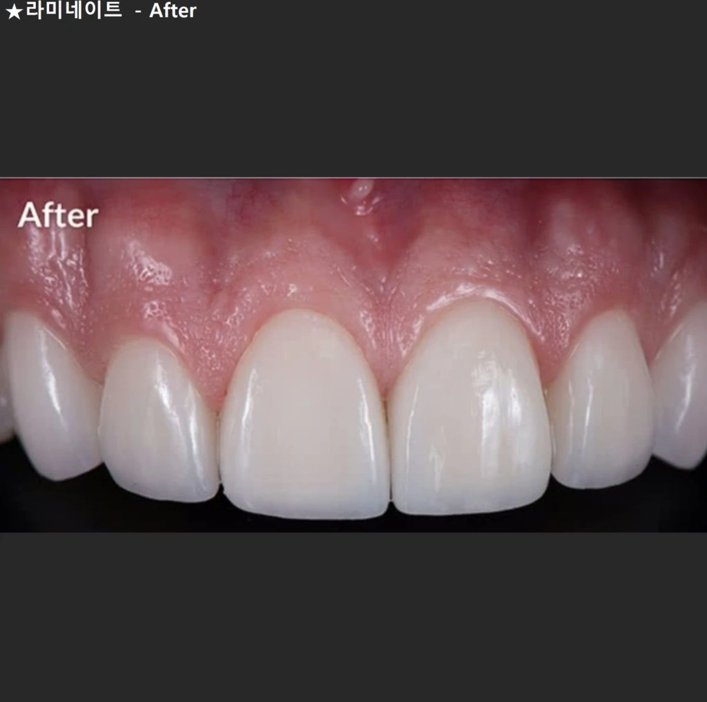 before_image