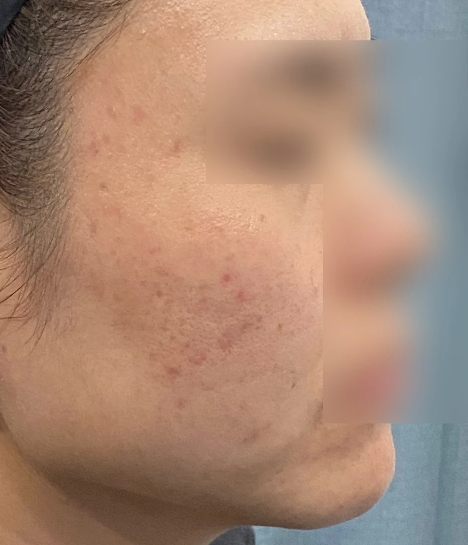 before_image