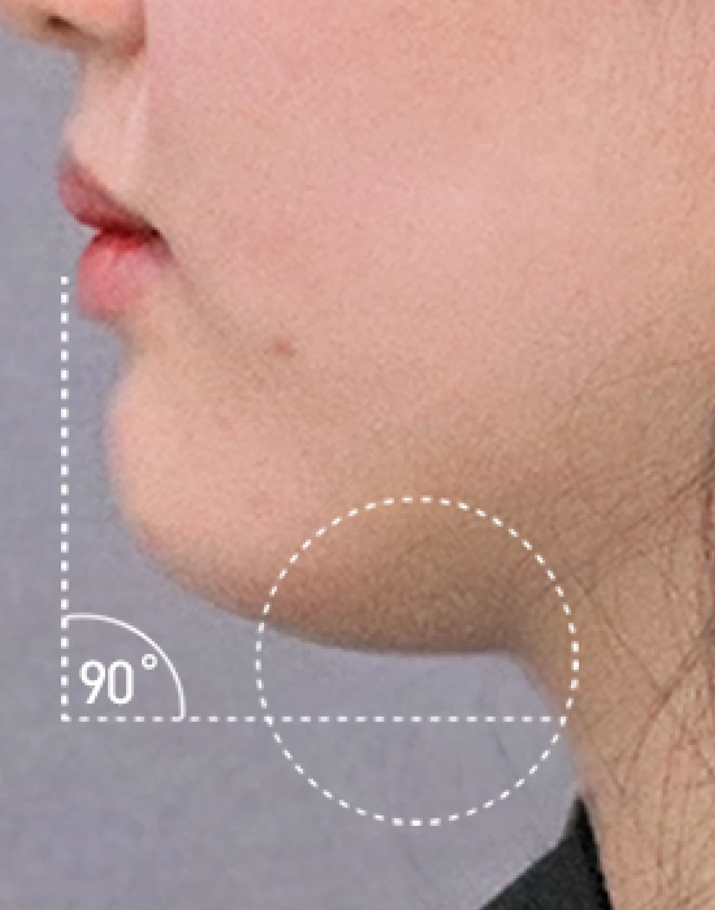 before_image