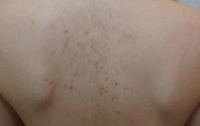 before_image