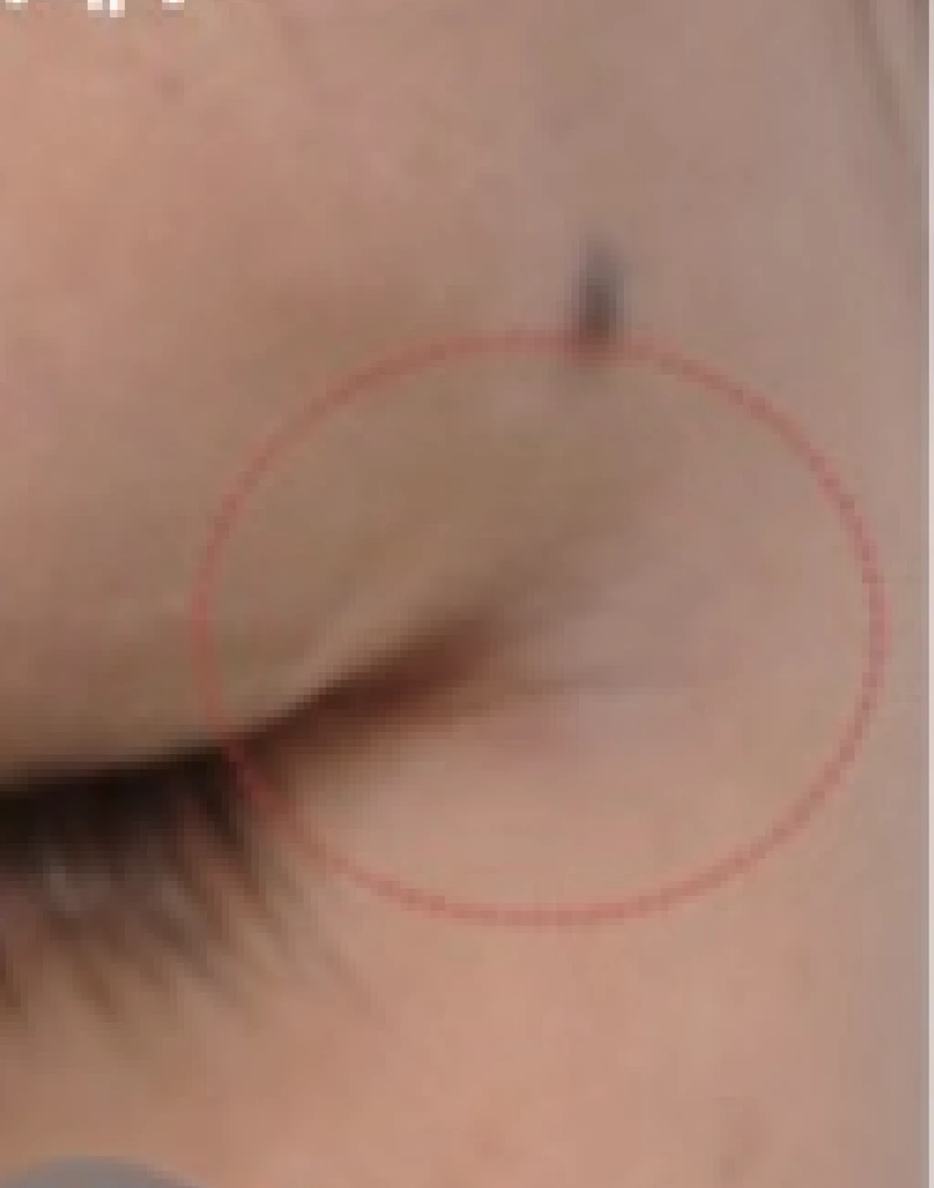 before_image